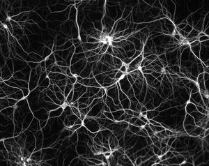 Les réseaux sont à l'image de notre cerveau : un tissu de neurones. Comme le rappelle Jean-Pierre Quignaux : 